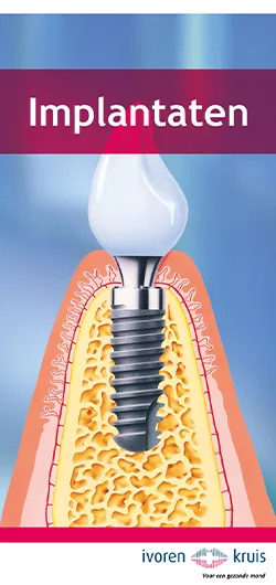 Implantaten